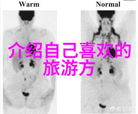 火箭少女101皮肤变身火箭少女101的华丽变身